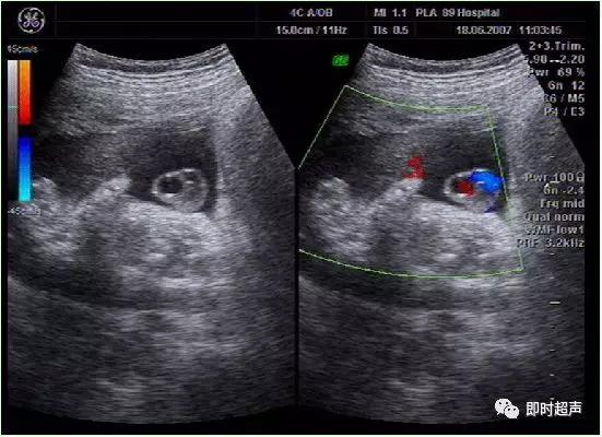 产科常规彩色超声报告单介绍,常见妇科疾病超声报告