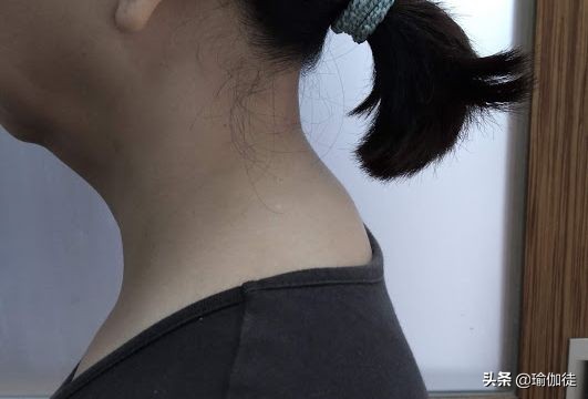 颈椎富贵包怎么消除最有效方法,怎样快速消除颈椎的富贵包