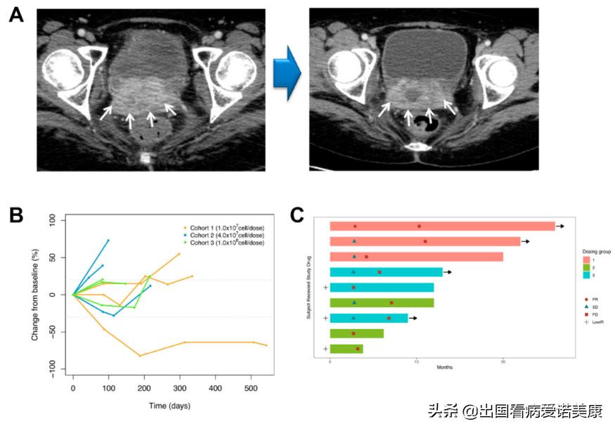 美国进口的宫颈癌疫苗能接种吗,进口宫颈癌疫苗预防率