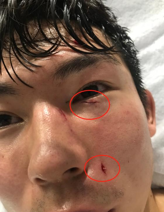 上港逃过红牌点球后轰然倒地,上海上港守门员受伤