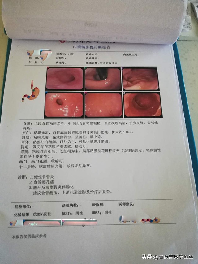 八十多岁的老太太胸腹总疼咋回事,76岁老人胸痛胸闷是怎么回事