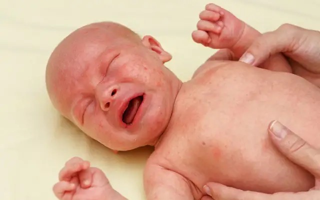 宝宝湿疹哺乳妈妈有必要忌口吗,宝宝湿疹都是妈妈的错