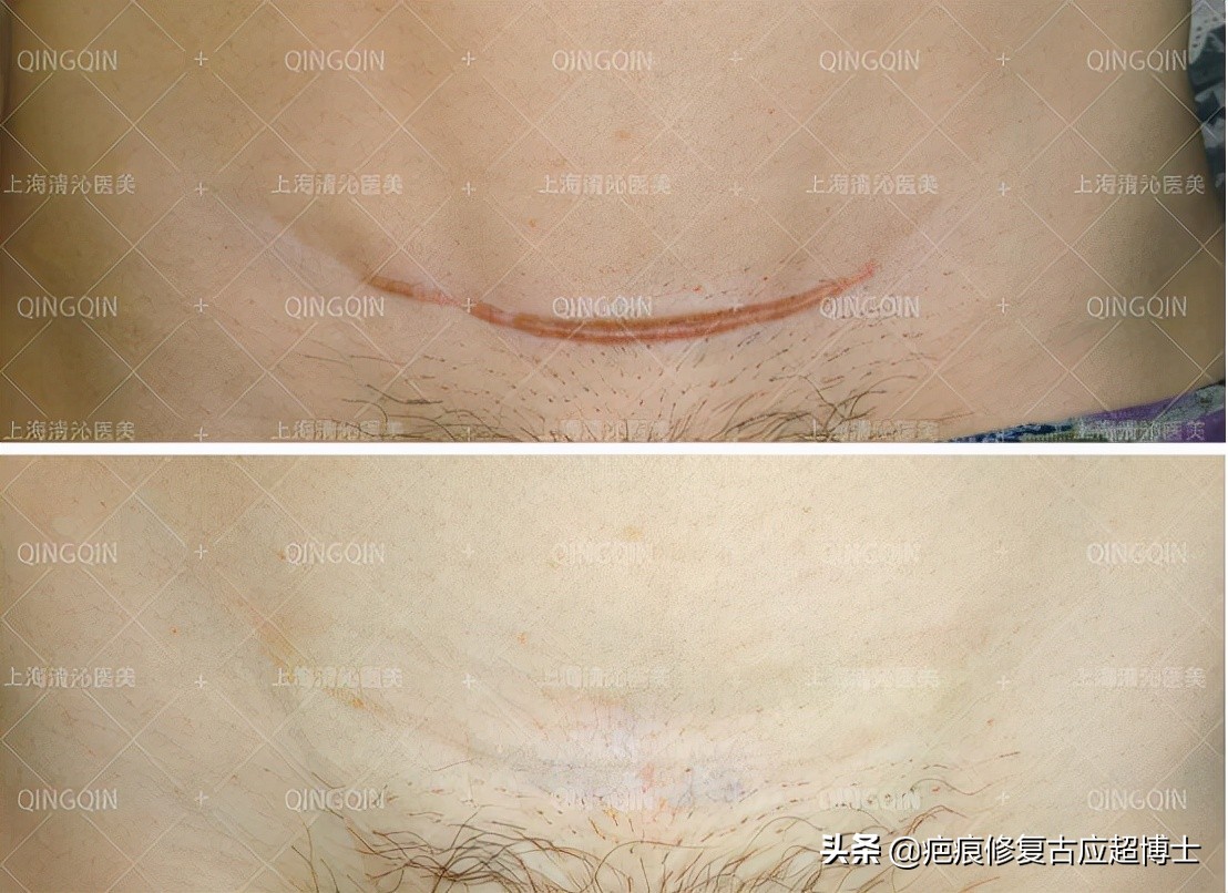 涓嶅繕鍒濆績鐮ョ牶鍓嶈鍖犲績绛戞ⅵ,涓嶅繕鍒濆績鍖犲績绛戞ⅵ