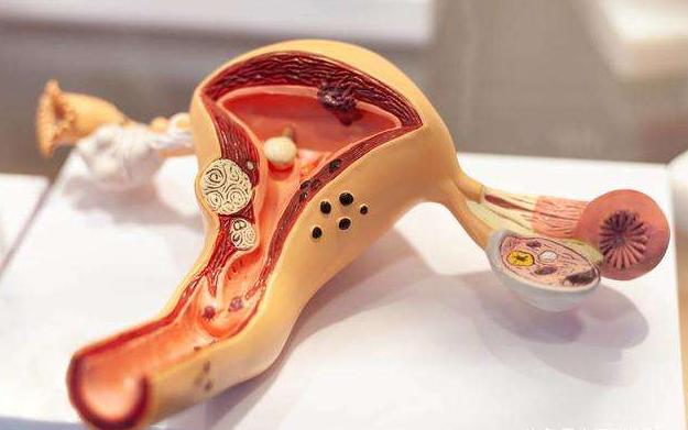 为什么没有了子宫就没有幸福呢,为什么没有子宫就不是女人了