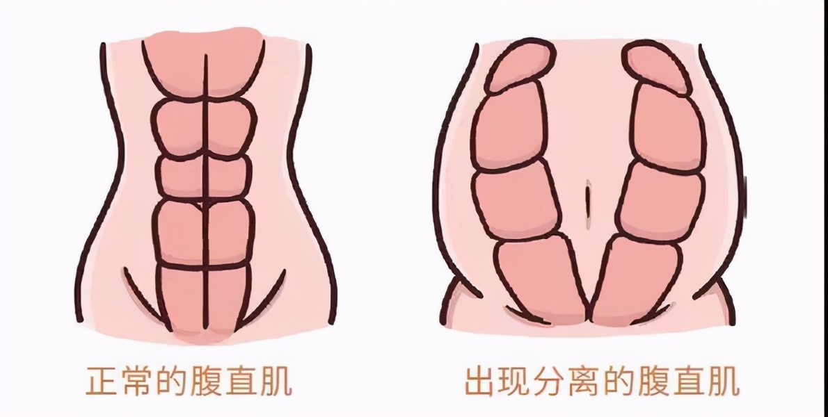 9个磨人的产后问题,中招的宝妈说“生活没了快乐”