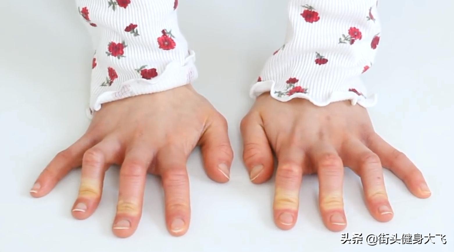 香蕉倒立如何转成完美直体倒立,倒立时腰无力怎么回事