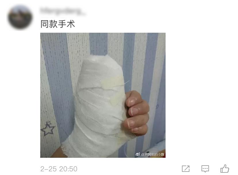 女星拔手指倒刺,女明星因拔倒刺住院