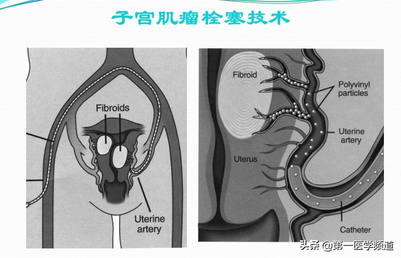 「医影传声」上海交通大学医学院附属瑞金医院卢湾分院放射科主任