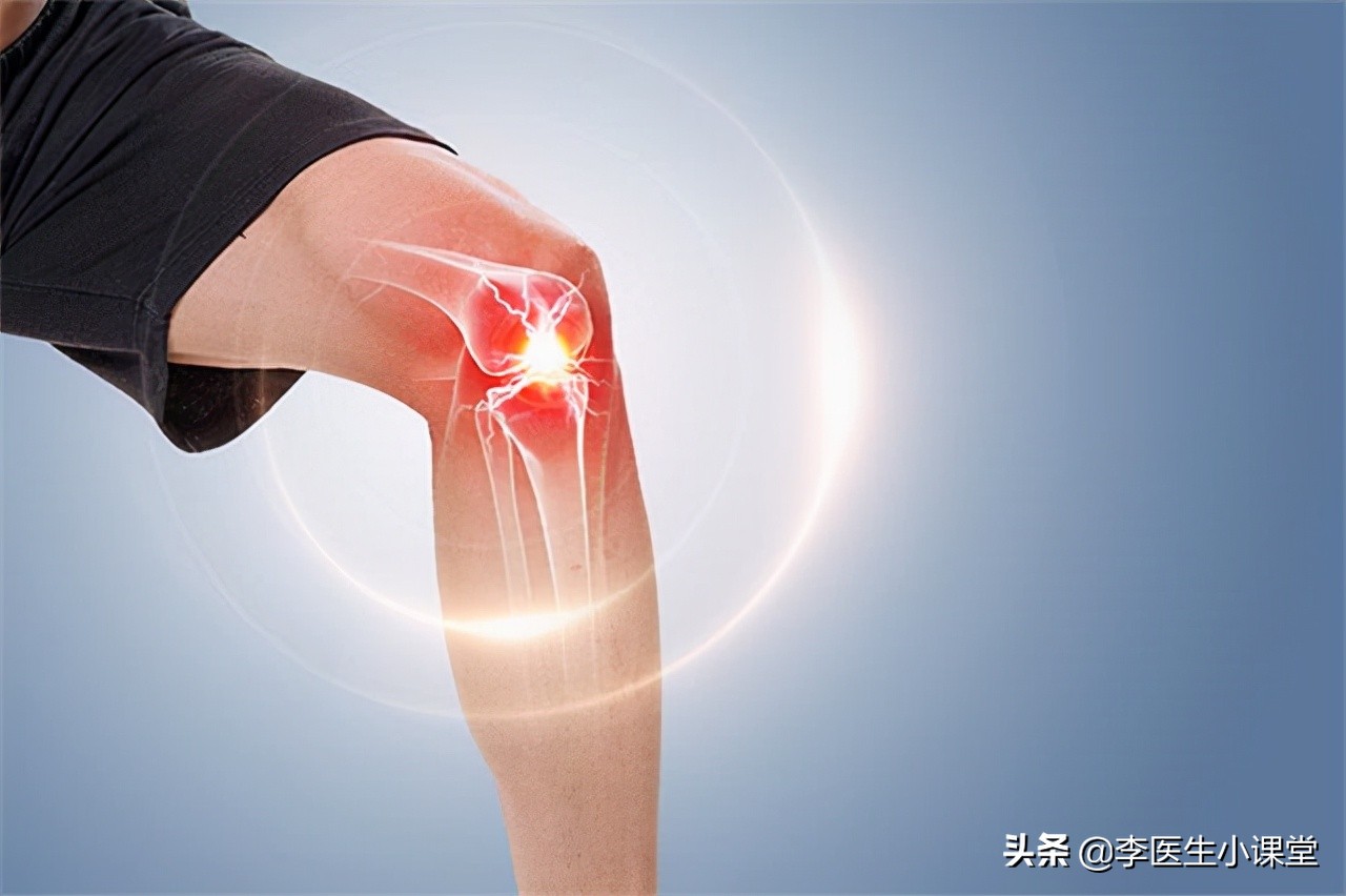 半月板损伤用什么样的膝关节支具,半月板损伤膝关节炎怎么治疗