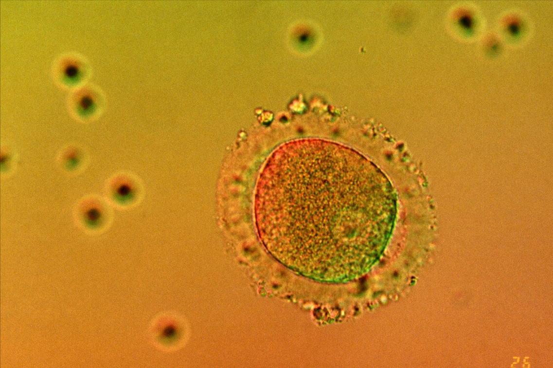 提高卵子质量生优秀宝宝，这四件事你做到了吗？