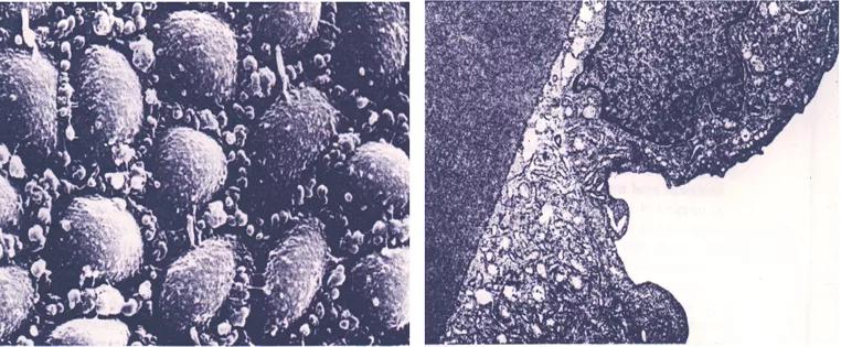 「学术交流」超声乳化手术与角膜内皮细胞保护