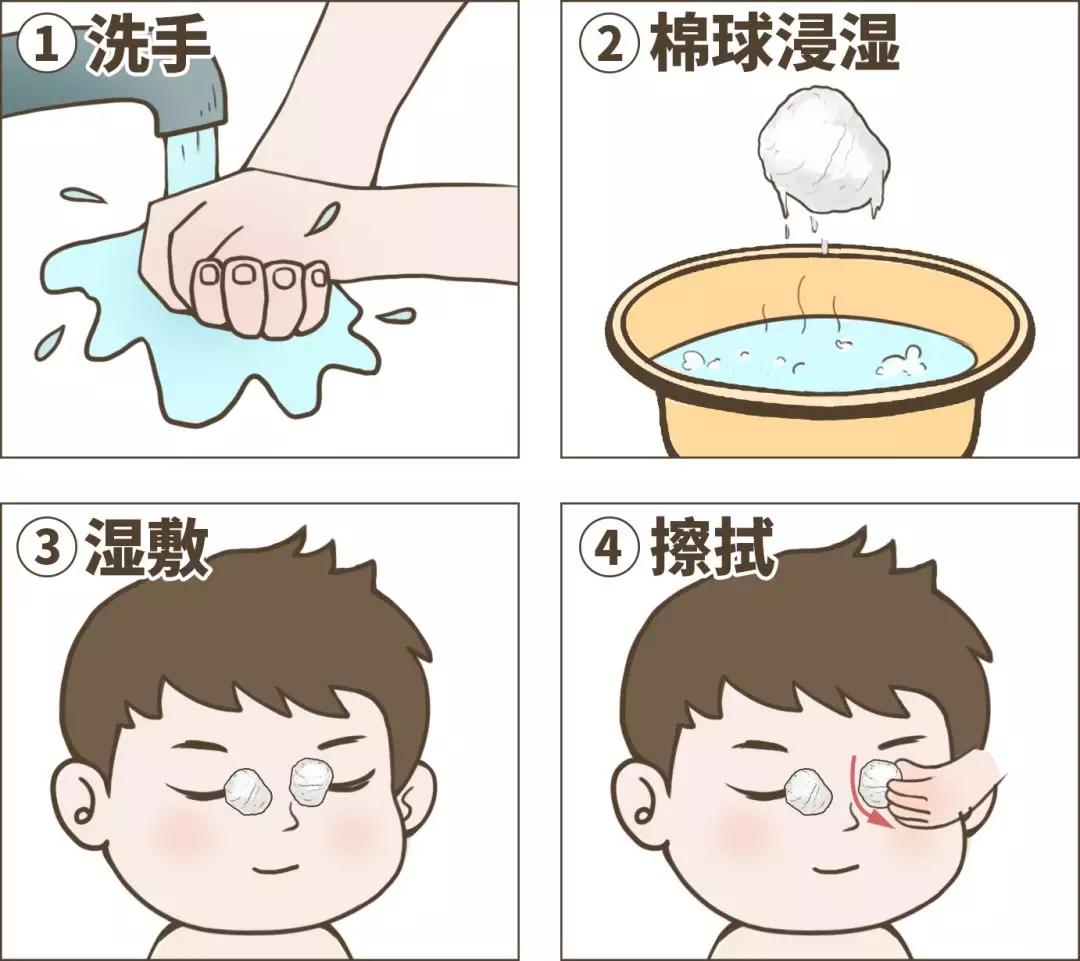 出现眼屎是不是上火了怎么调理,孩子感冒上火眼睛有黄眼屎怎么办