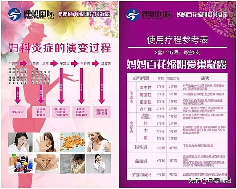 宝宝霜强效修护,消字号激素宝宝霜