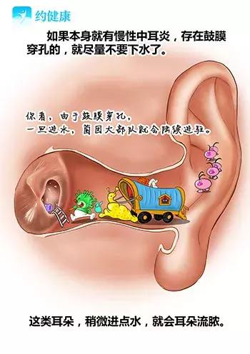游泳耳朵里进水排不出来怎么办,游泳耳朵进水像堵了一层膜听不清