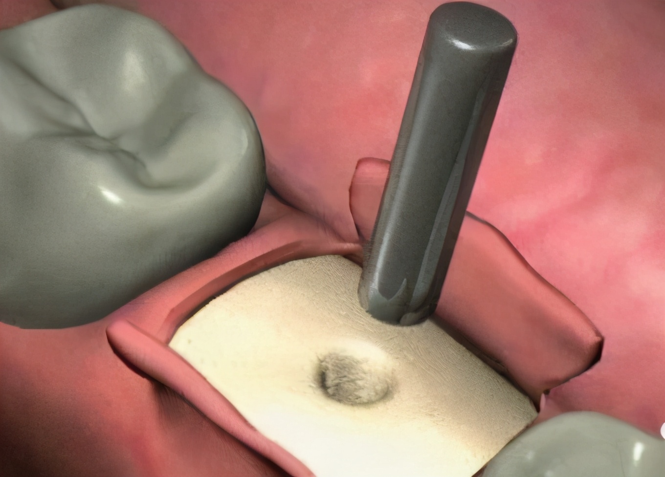 上海雅悦齿科地址,开立特上海雅悦齿科