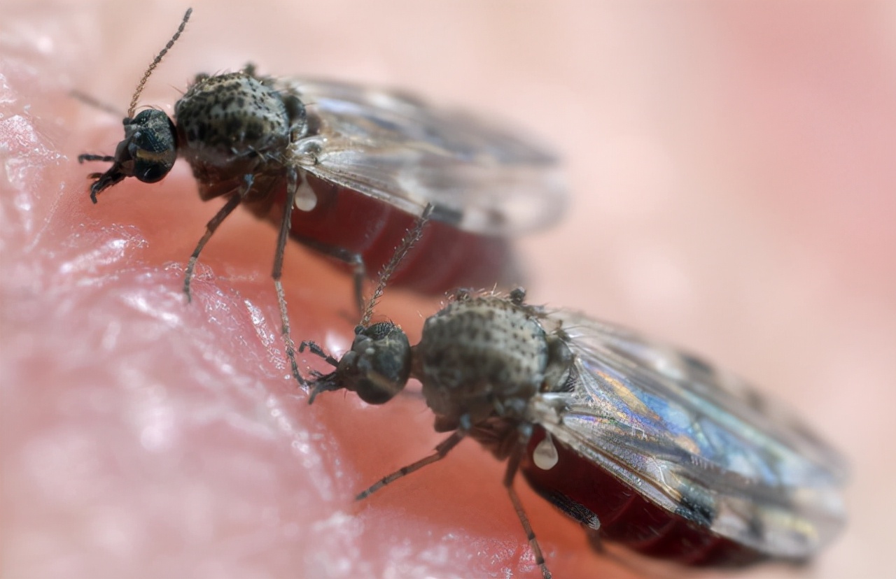 男性腿毛旺盛的坏处,男性腿毛稀疏是因为什么