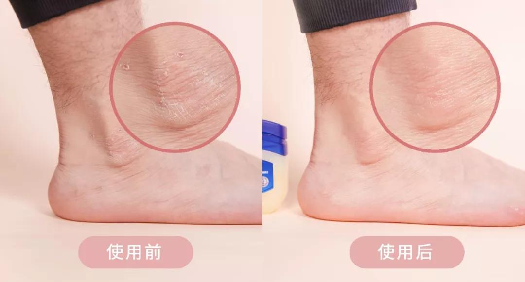 李佳琦卖断货的国货,李佳琦凡士林晶冻唇膏