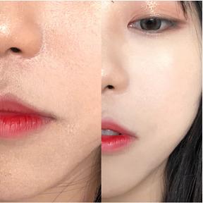 真正有效的芦荟胶,安全好用的芦荟胶