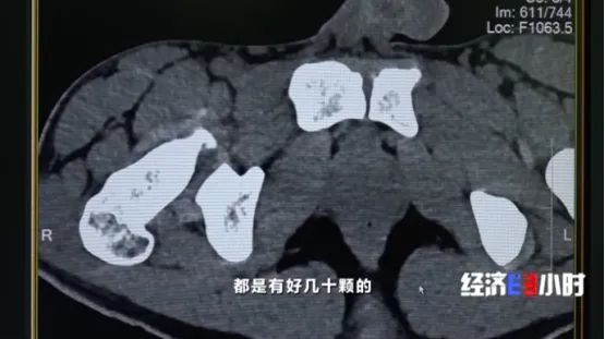 小伙为还7万元沦为“工具人”被迫运毒险些丧命