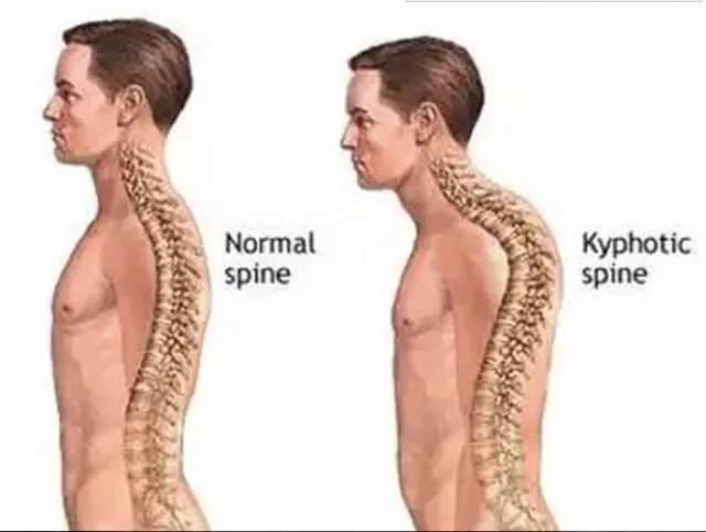 一文带你了解～气质杀手！比矮还要可怕的是脖子短粗