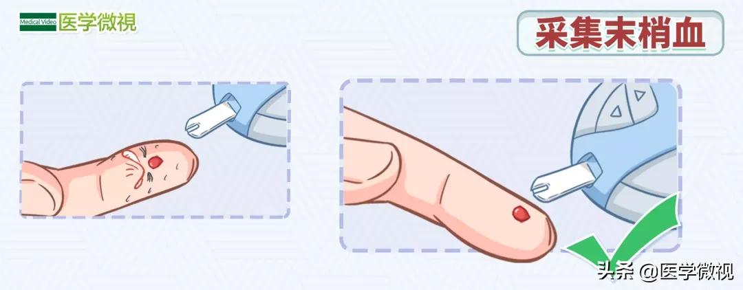 自己在家监测血糖,应该扎哪个手指?