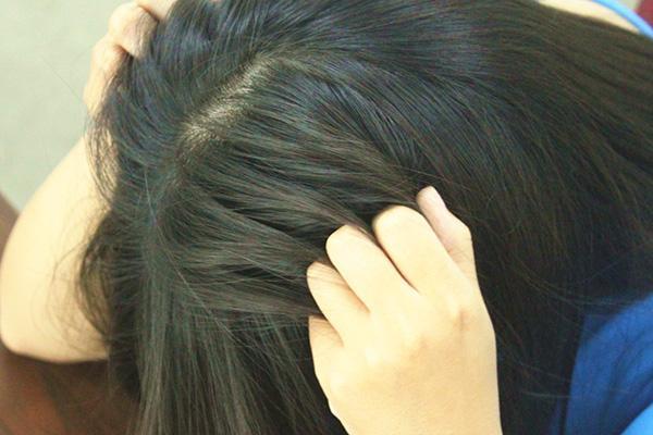 为什么抓头的时候指甲缝里有白泥,挖头皮时指甲里有白泥是什么