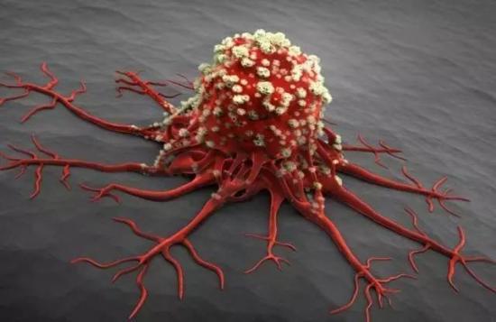 不吃饭能饿死肿瘤细胞吗,饿死的肿瘤怎么处理