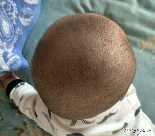 宝宝睡觉睡得偏头，还能补救吗？