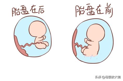 孕早期一旦出现这这些情况，准妈妈们要注意，最好去医院！莫大意