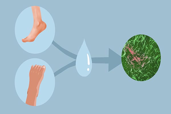 经常脚痒是脚气还是真菌,脚气用什么泡脚可以缓解脚痒