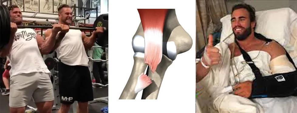 一个月训练强度大却没效果,为什么坚持三个月训练没有变化