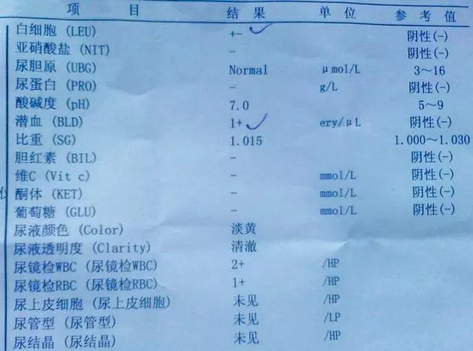 尿潜血诊疗指南,尿潜血是泌尿系感染吗