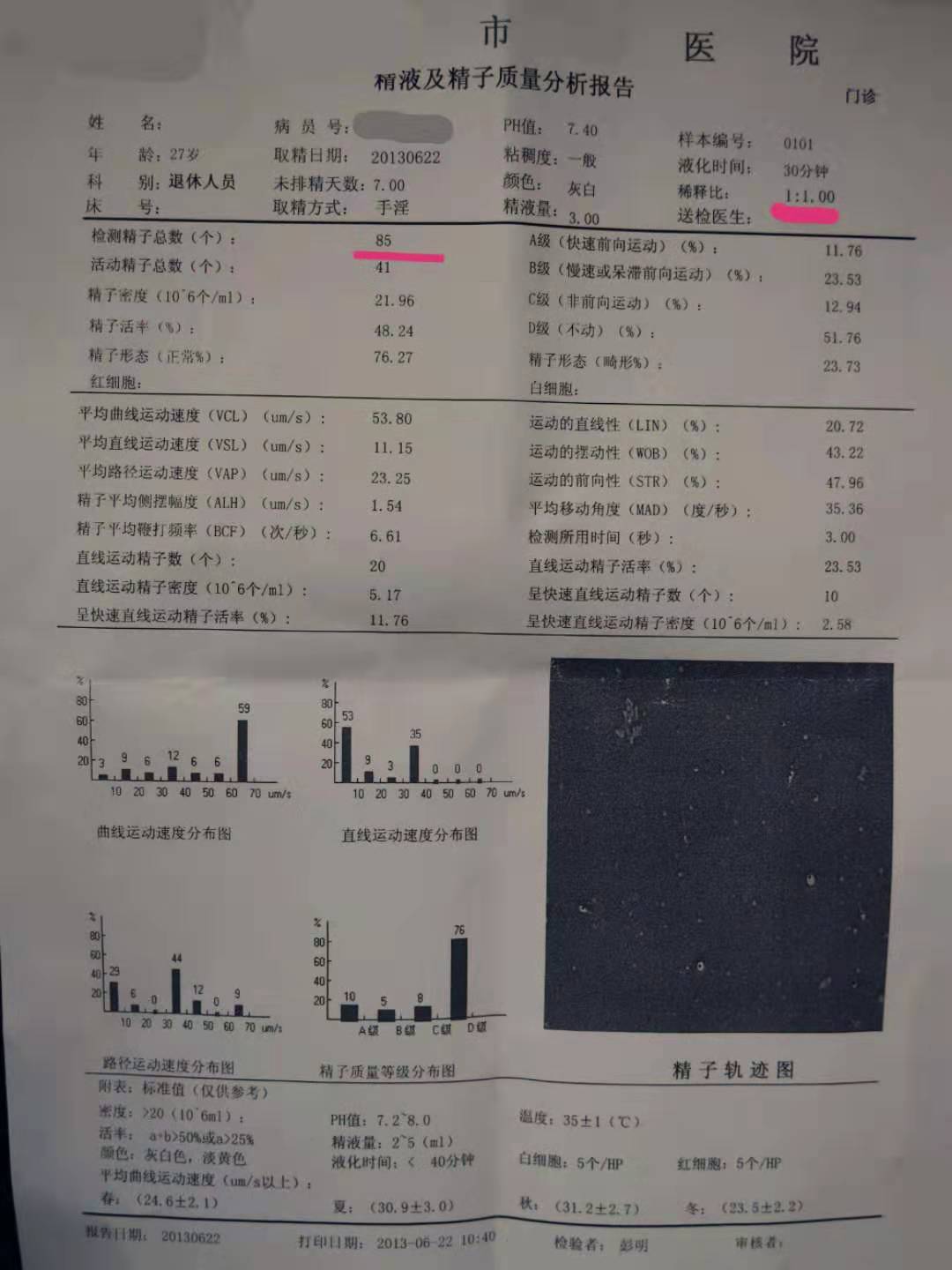 小蝌蚪检测需要多久,小蝌蚪常规报告怎么看