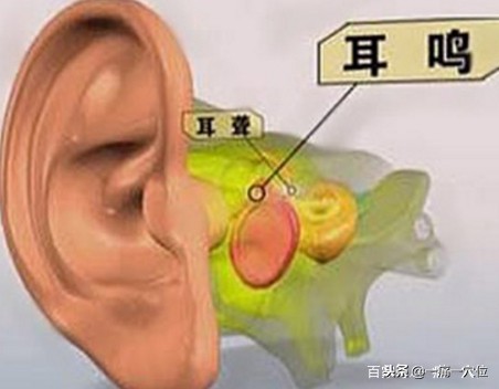 耳鸣每天锻炼能有好转吗,耳鸣坚持做2个动作