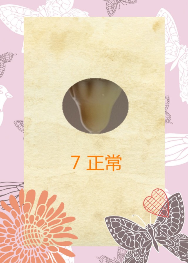 你的Jing液颜色，正常吗？