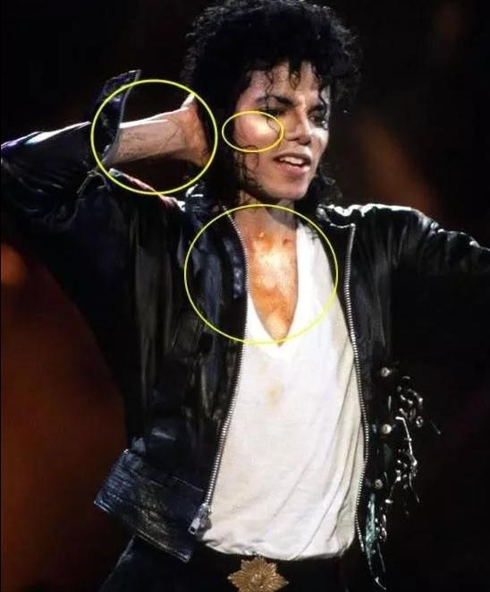 迈克尔·杰克逊演唱会晕倒5000人，死亡23人，他却被控娈童、整容