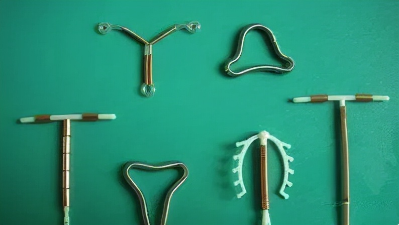 上环真有那么可怕吗,上环的误区