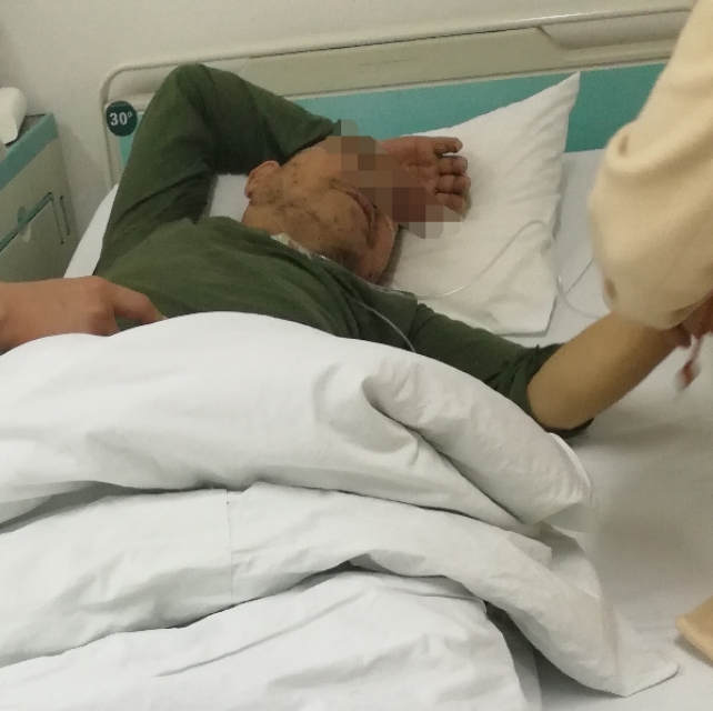 盗汗是淋巴瘤早期症状吗,失眠盗汗是哪种类型淋巴瘤