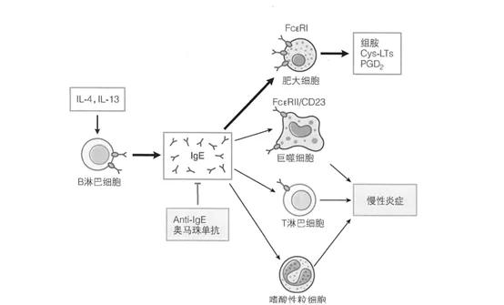 奥马珠单抗治疗荨麻疹临床试验,奥马珠单抗治好荨麻疹的案例