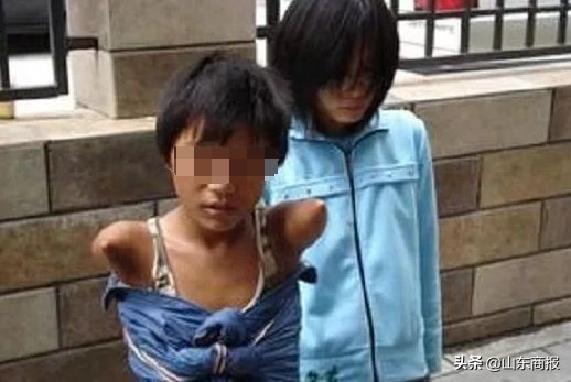 眼球被挖的人后续,眼球被挖了还能医吗