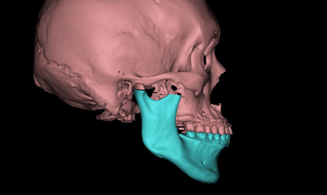 唇形不好看怎么矫正脸型,唇形状不好如何矫正