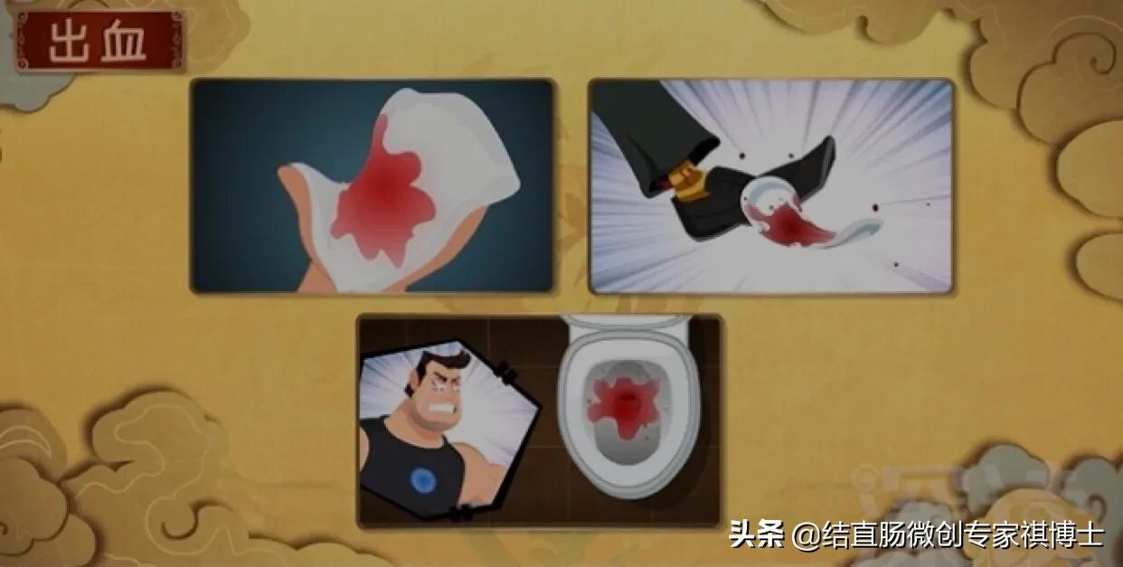 什么是混合痔疮的症状,得了痔疮会有哪些症状