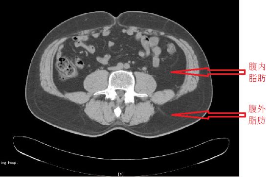 为什么体脂秤误差很大,家用体脂秤是否有参考性
