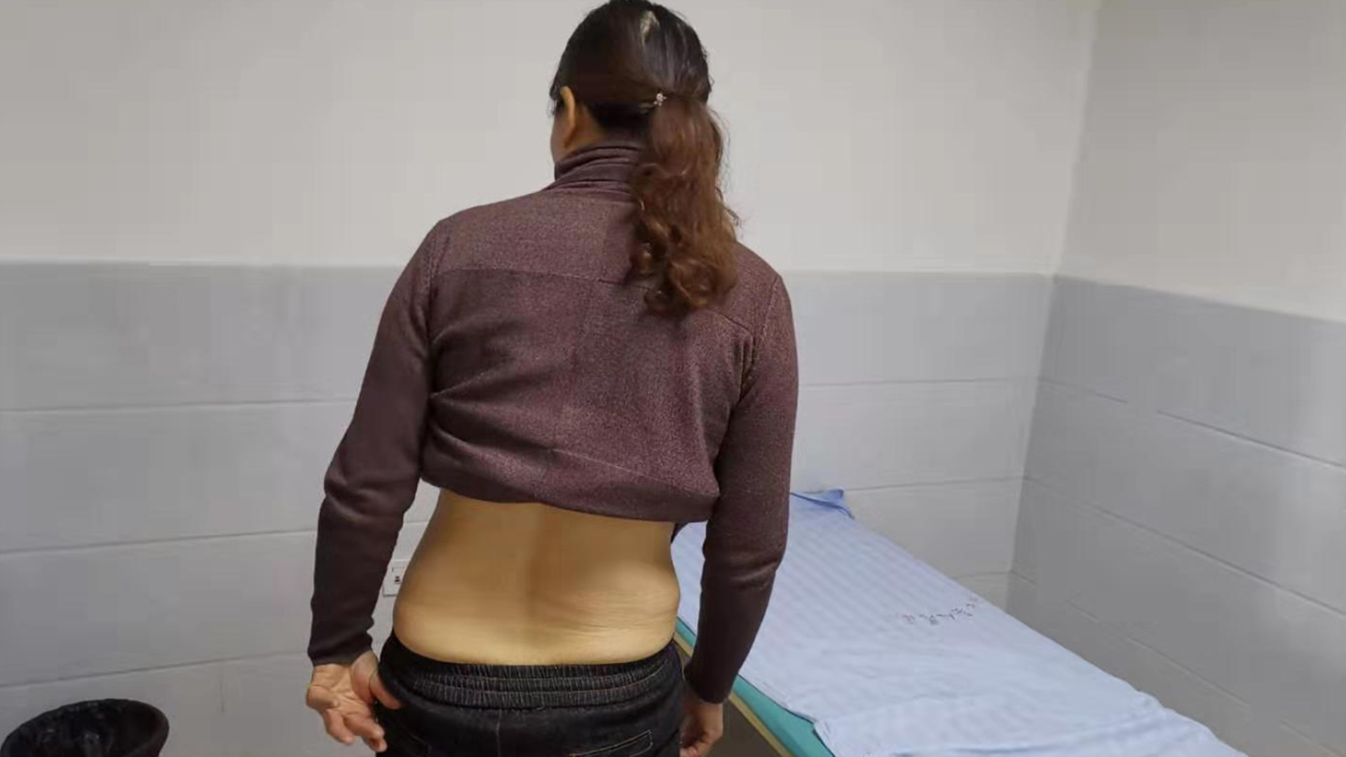 椎间盘突出腰腿疼消失,椎间盘突出腰腿痛能根治吗