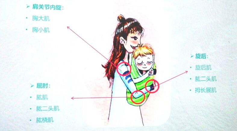 产后抱娃手臂手指酸痛无力咋办？4个方法、2个窍门帮你解除疼痛