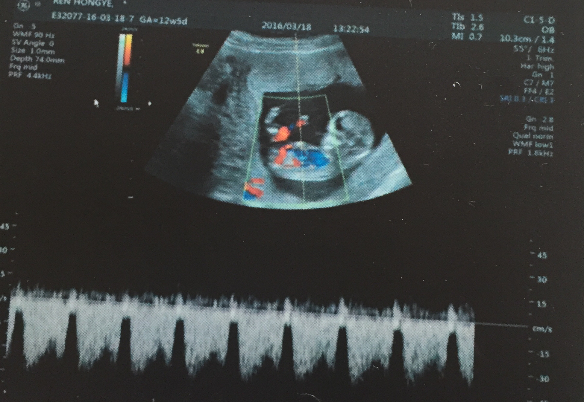 一份营养合理的一日食谱,学生营养餐一日食谱视频