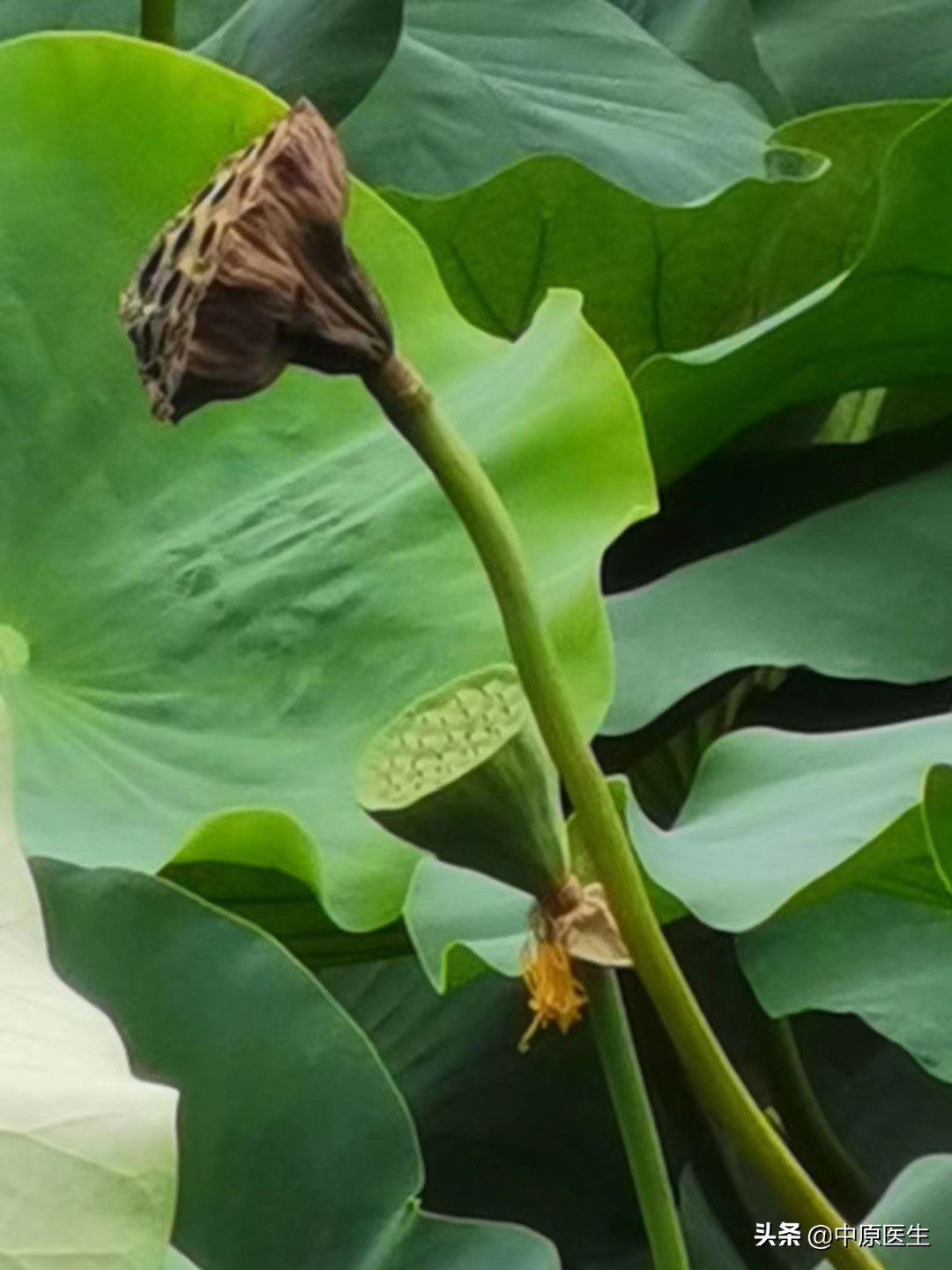 50岁大妈吃三七粉险丧命,三七粉70岁以上老人喝了好吗