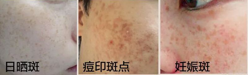 58岁的她芳华依旧,58岁的她依然年轻