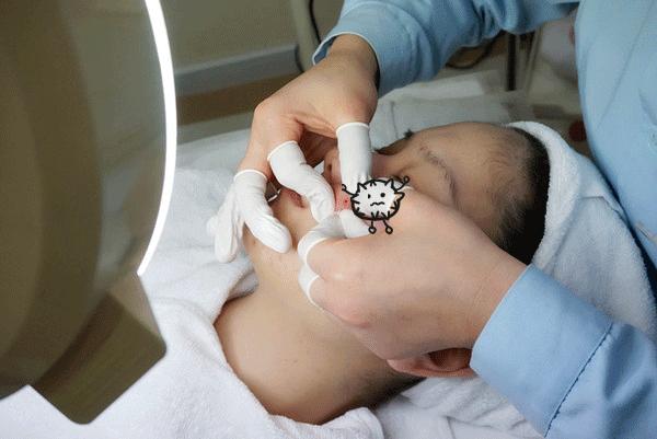 祛痘、脱毛、洗牙？点开这篇文章，离女神更近一步