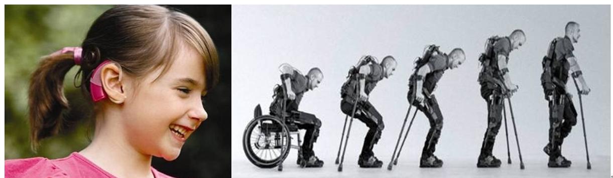 社保改成医保,赛博格cyborg